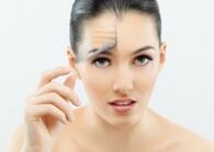 Ragazza dopo il ringiovanimento facciale laser frazionato